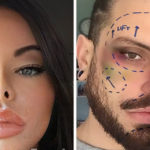 Perché Instagram ha deciso di vietare i filtri effetto lifting / chirurgia plastica