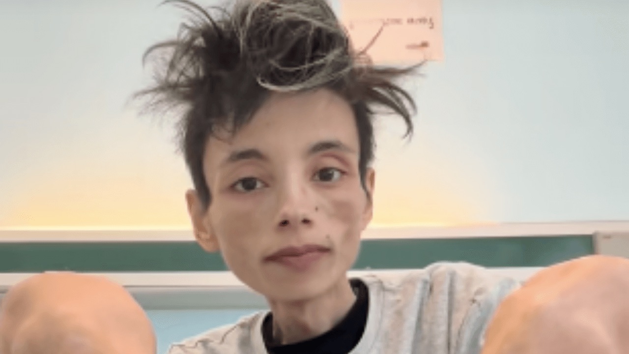 È morto a 27 anni Thiago Elar, il ragazzo che chiedeva aiuto su TikTok È morto a 27 anni Thiago Elar, il ragazzo che chiedeva aiuto su TikTok