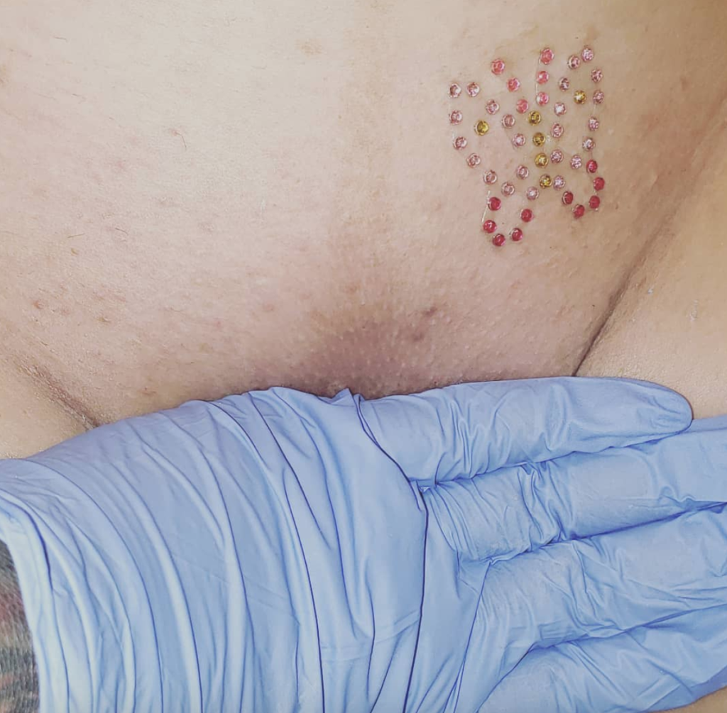 Vajazzling, la decorazione che fa splendere la vagina: chi la fa e controindicazioni