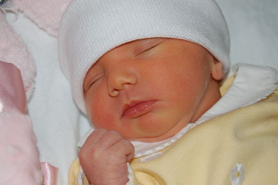Ittero Nei Neonati Cause E Terapie Roba Da Mamme