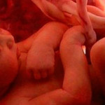 Il Cordone Ombelicale, Quel Simbolo di Unione tra Mamma e Bambino che Potrebbe Aiutare la Ricerca