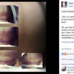 Parto cesareo: il dolore nello sfogo di una mamma su Facebook