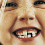 Come curare al meglio i denti da latte