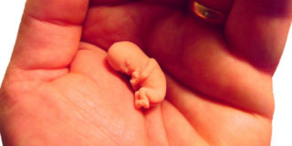 aborto terapeutico cos'è