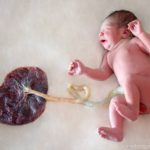 Ha senso praticare il Lotus Birth, ovvero non recidere subito il cordone ombelicale?