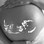 Sacco vitellino: perché il primo segnale visibile della gravidanza