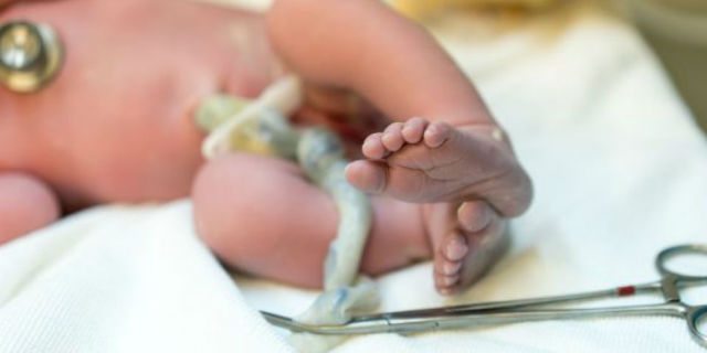 lotus birth