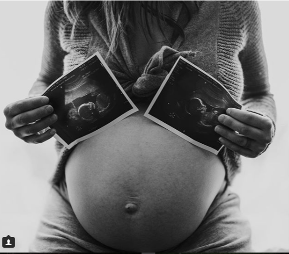 "Perché dovremmo condividere tutte le foto del nostro corpo dopo il parto"