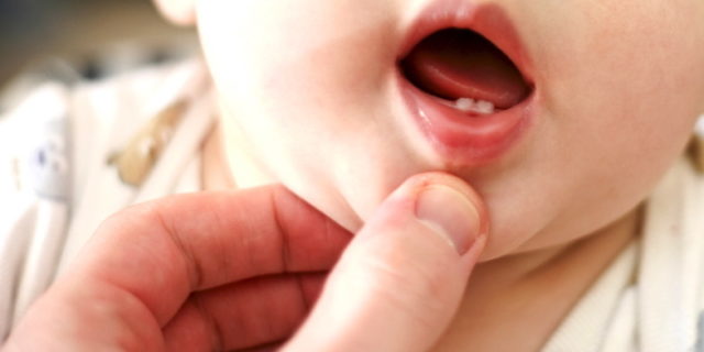 dentizione neonati