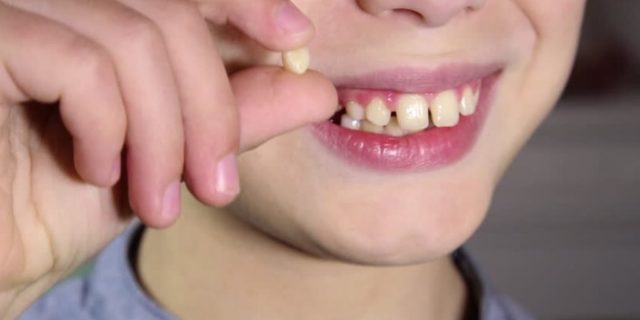dentizione bambini
