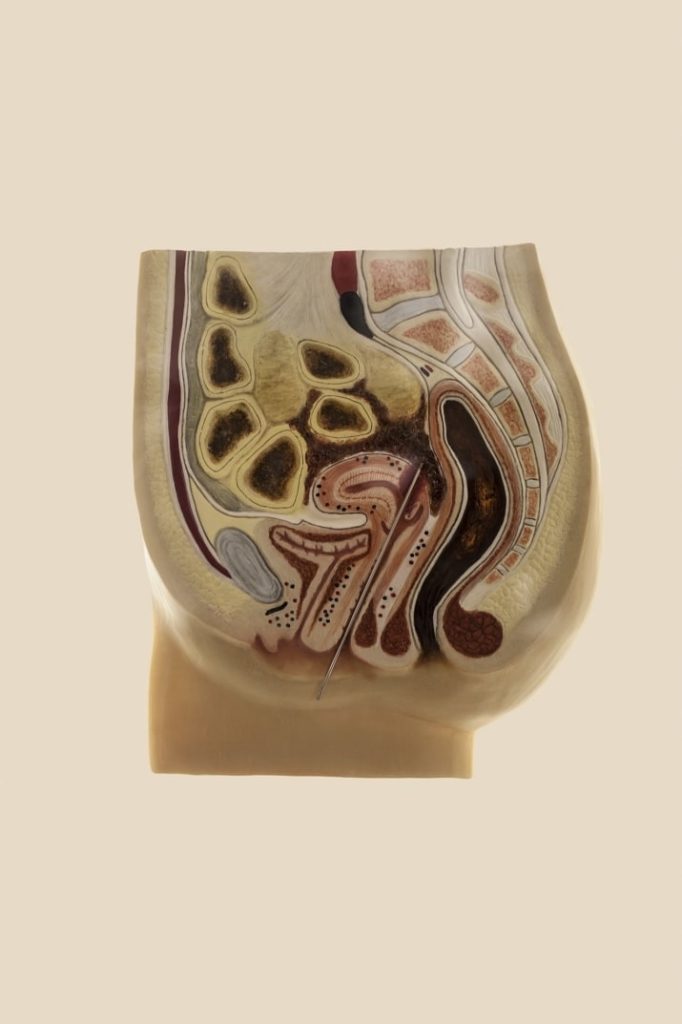 11 immagini che catturano l'orrore dell'aborto illegale
