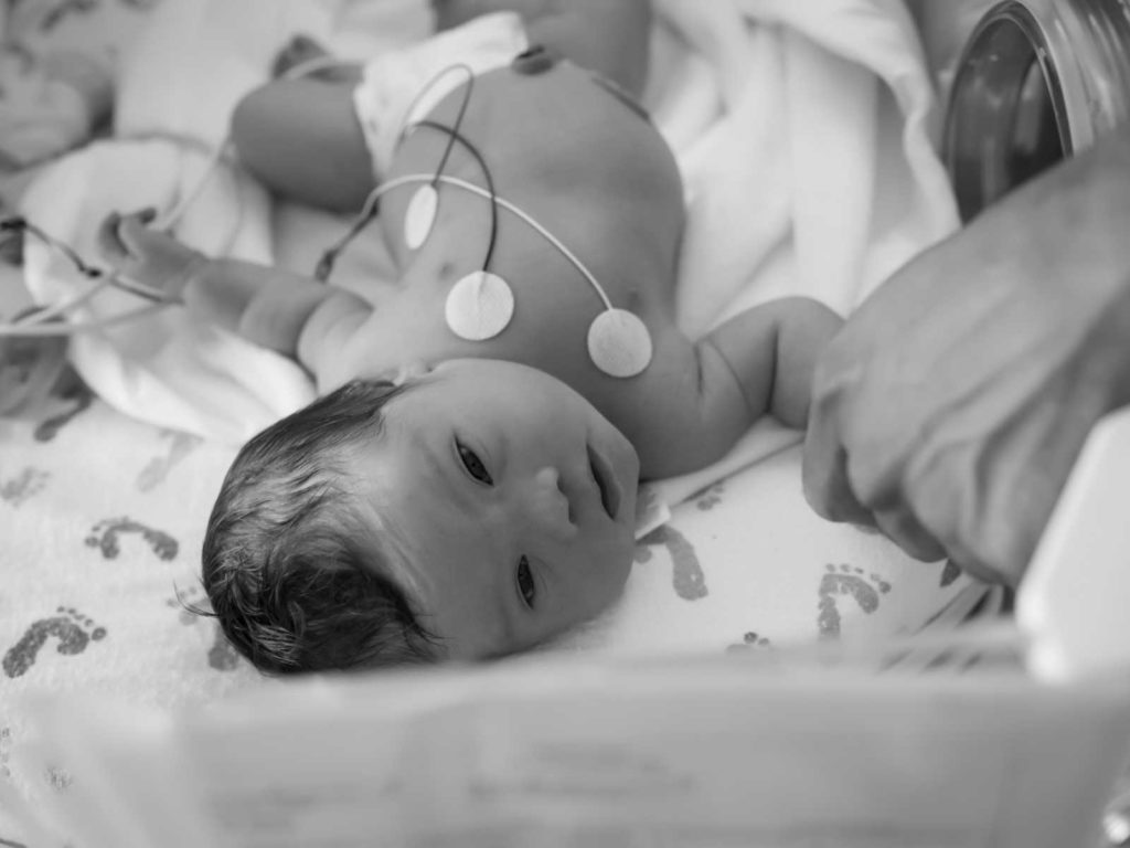 "Sei perfetta": la mamma scopre dopo il parto in acqua che la figlia è down