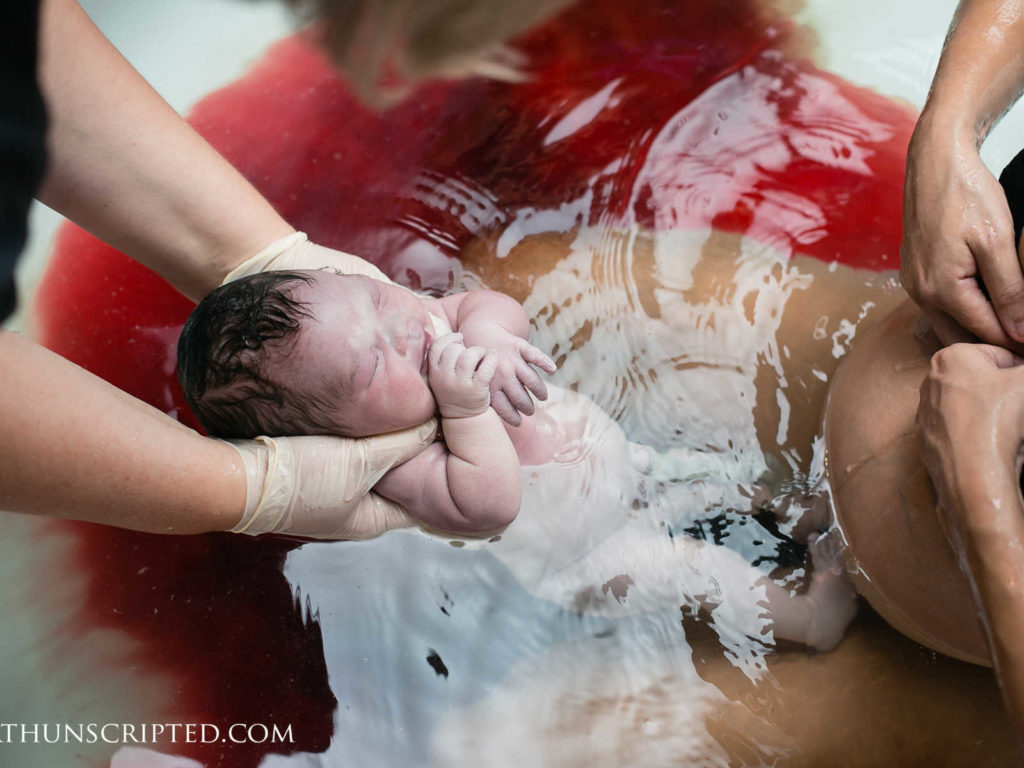 "Sei perfetta": la mamma scopre dopo il parto in acqua che la figlia è down