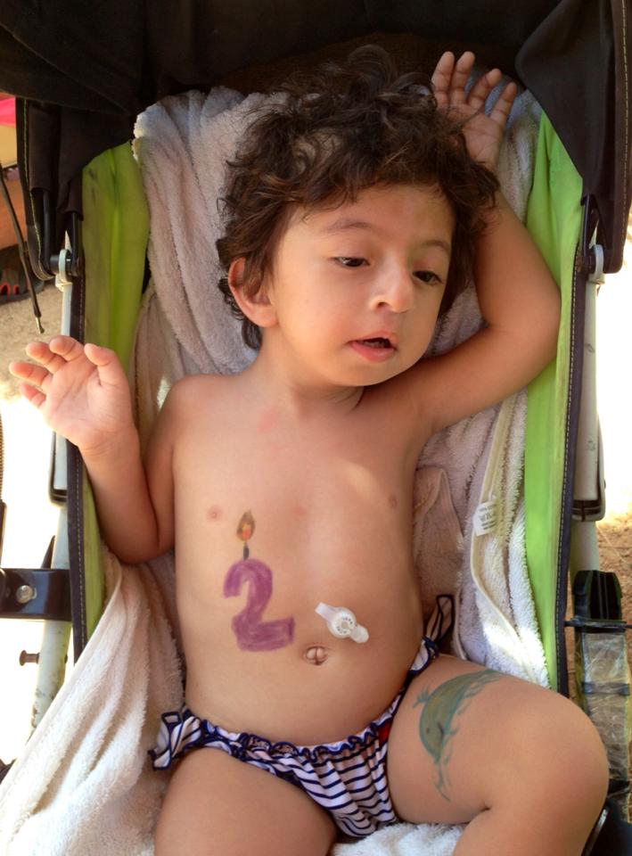 "Io ci sono ancora e sono mamma di una bimba con una malattia rarissima"