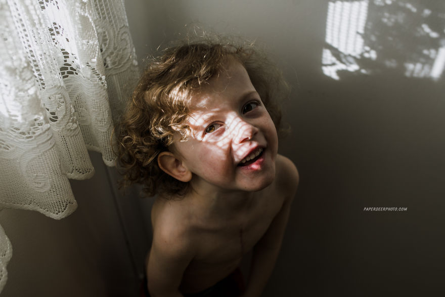 "La storia di nostro figlio di 4 anni e delle sue 3 operazioni a cuore aperto"