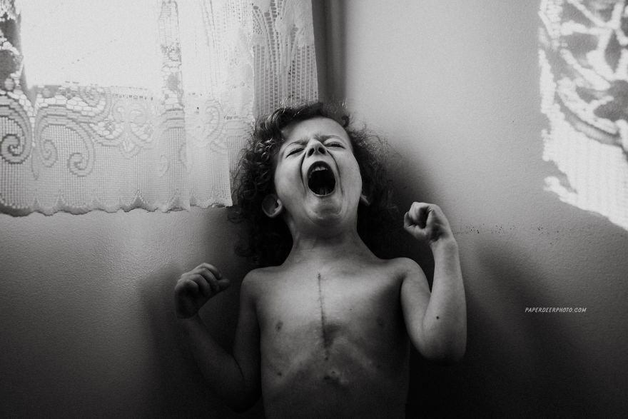 "La storia di nostro figlio di 4 anni e delle sue 3 operazioni a cuore aperto"