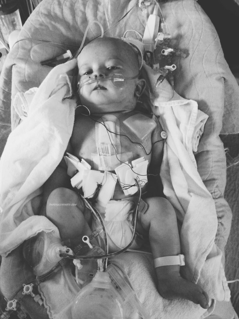 "La storia di nostro figlio di 4 anni e delle sue 3 operazioni a cuore aperto"