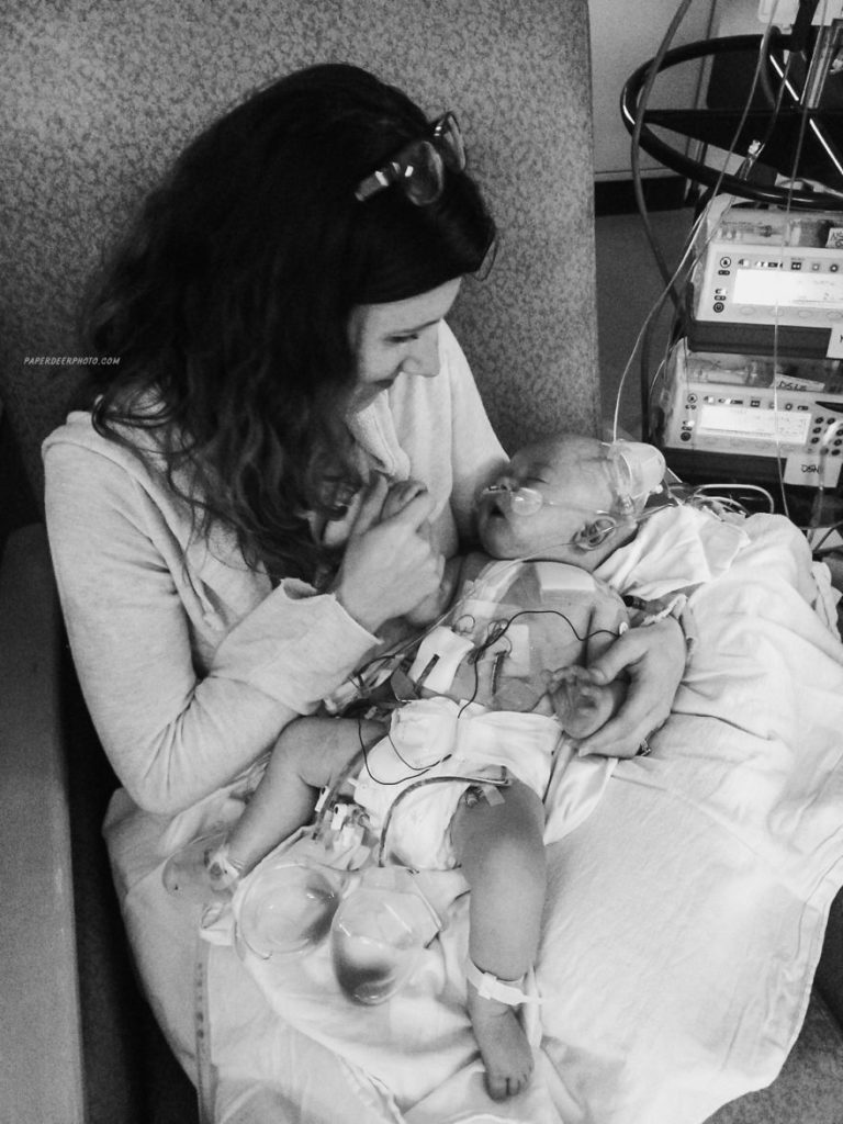 "La storia di nostro figlio di 4 anni e delle sue 3 operazioni a cuore aperto"