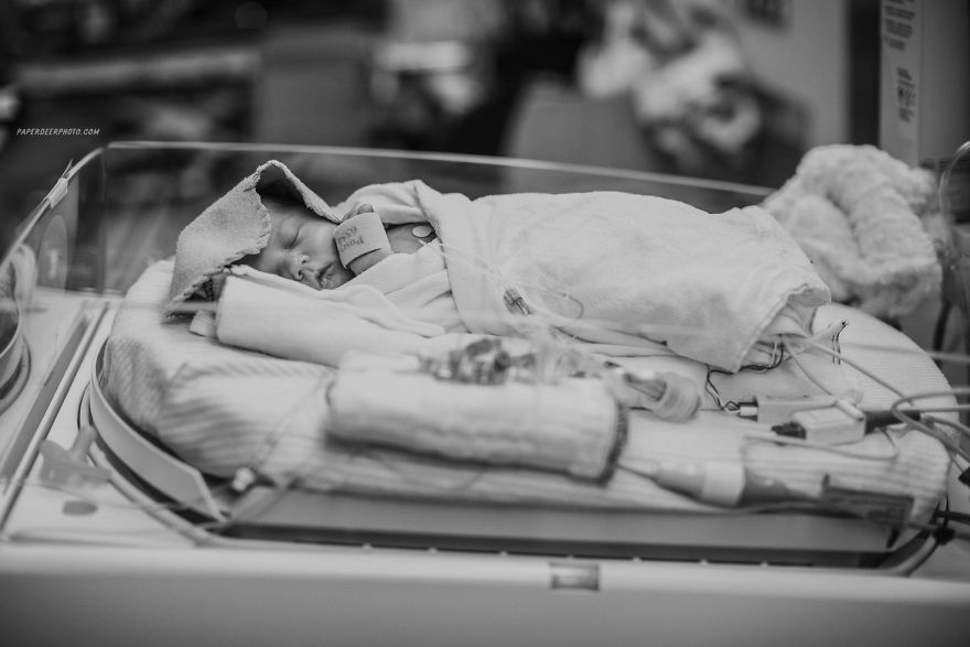 "La storia di nostro figlio di 4 anni e delle sue 3 operazioni a cuore aperto"