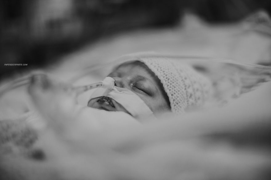 "La storia di nostro figlio di 4 anni e delle sue 3 operazioni a cuore aperto"