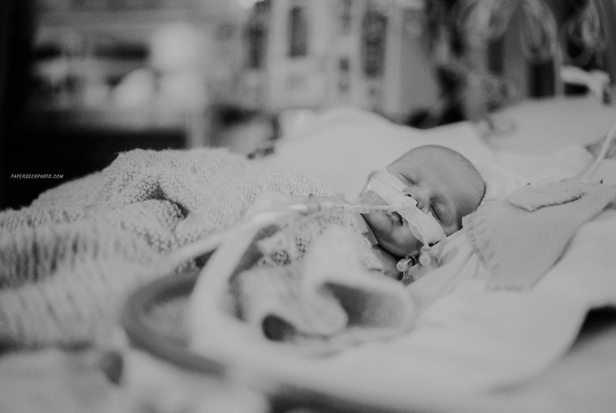 "La storia di nostro figlio di 4 anni e delle sue 3 operazioni a cuore aperto"