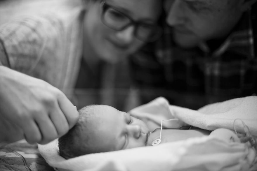 "La storia di nostro figlio di 4 anni e delle sue 3 operazioni a cuore aperto"