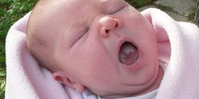 mughetto neonato cause