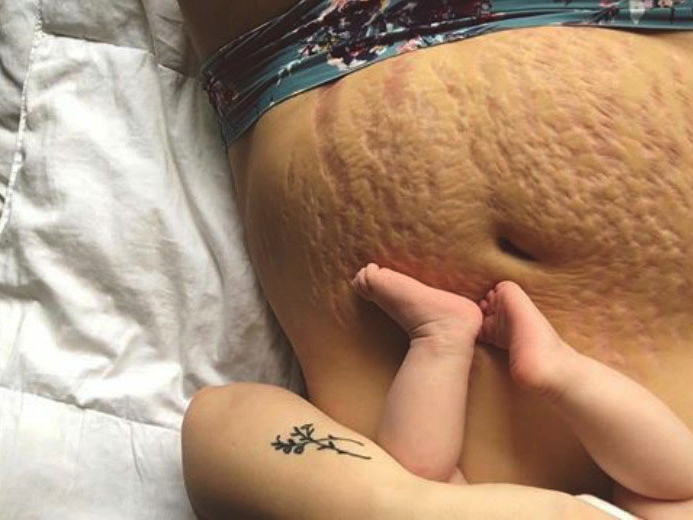 15 foto che raccontano la verità sul post parto che nessuno dice