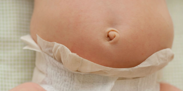 ernia ombelicale del neonato rimedi