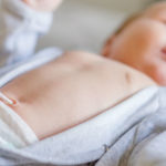 L'ernia ombelicale del neonato, uno dei disturbi più frequenti nei bambini