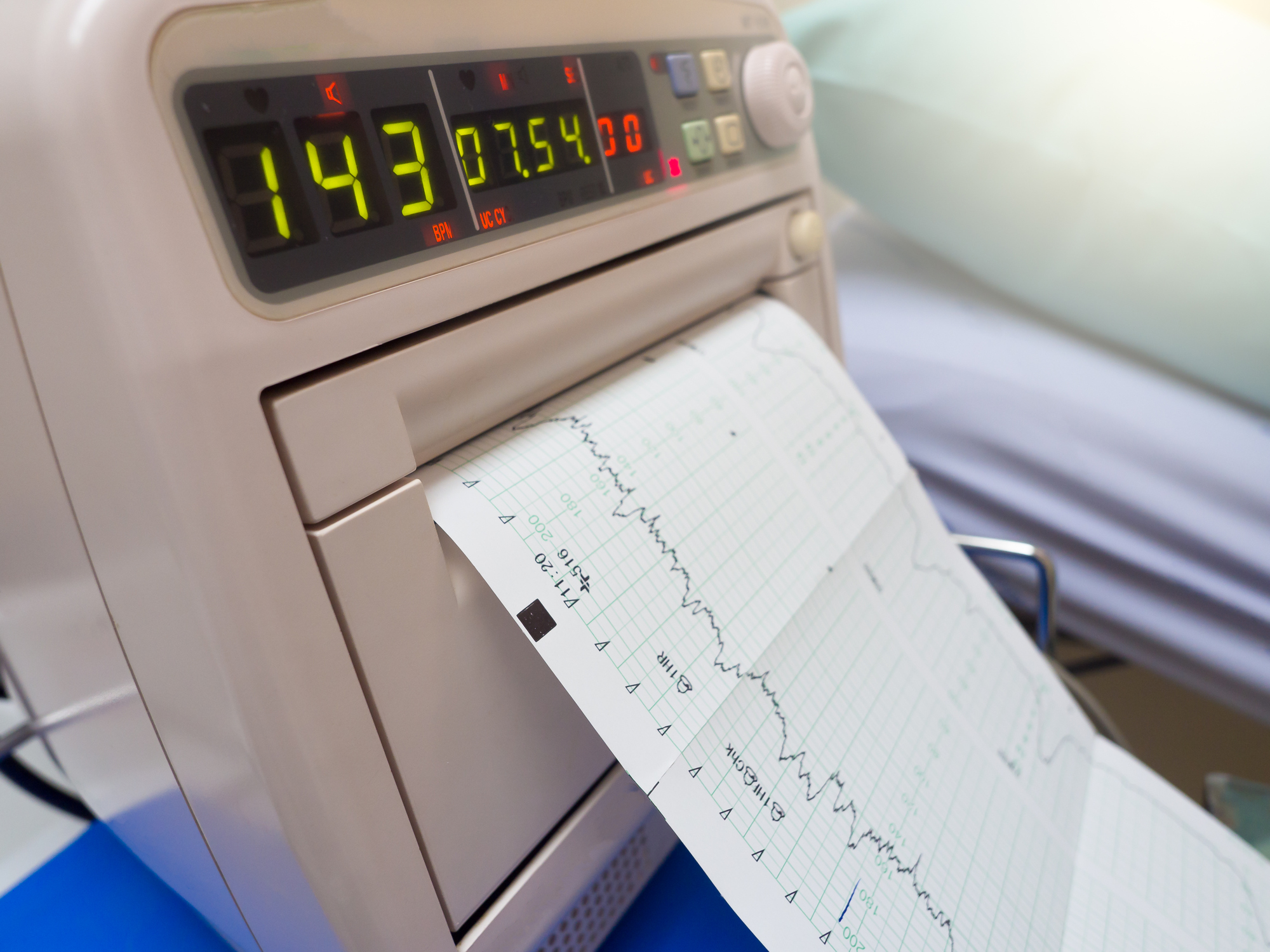 Cardiotocografia A Cosa Serve E Come Si Svolge Roba Da Donne