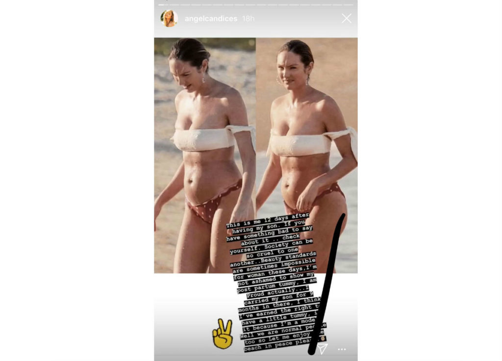 Anche gli angeli di Victoria's Secrets hanno pancia, smagliature e paure dopo il parto