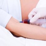 Harmony test: l'esame non invasivo in grado di rilevare patologie cromosomiche