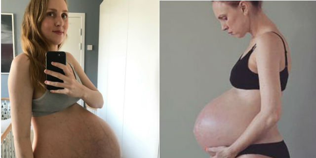 Come cambia il corpo (e non solo!) se sei incinta di 3 gemelli in 13 immagini Come cambia il corpo (e non solo!) se sei incinta di 3 gemelli in 13 immagini