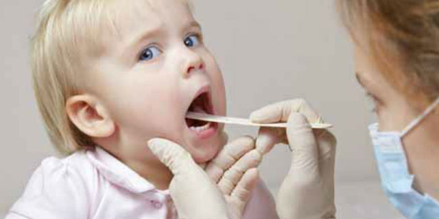 mononucleosi bambini sintomi