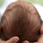La brachicefalia: quando la testa del neonato si appiattisce