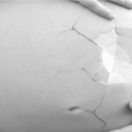 8 storie vere di aborto prima della legalizzazione