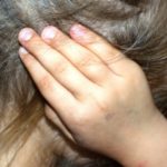 L'otite nei bambini: mai sottovalutarla