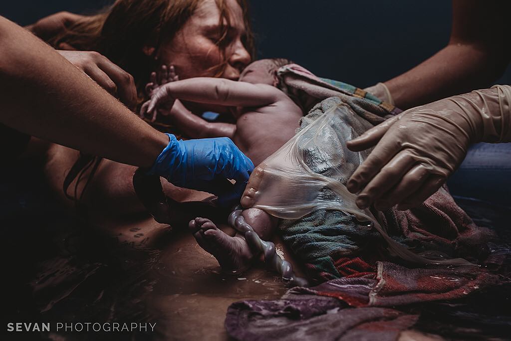 Il miracolo crudo e poetico della nascita in 9 foto vincitrici del 2019