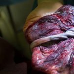 6 cose che la placenta dice sulla salute della mamma e del bambino