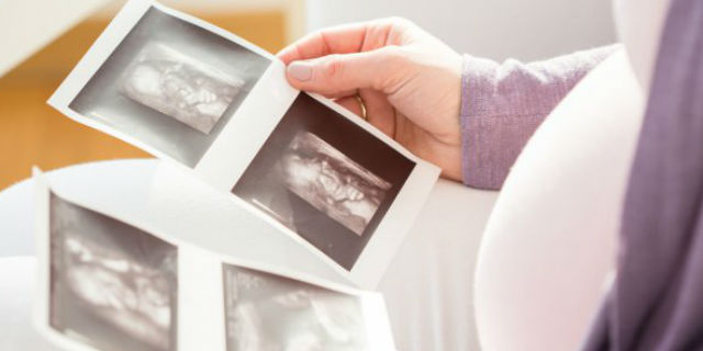 fetus in fetu