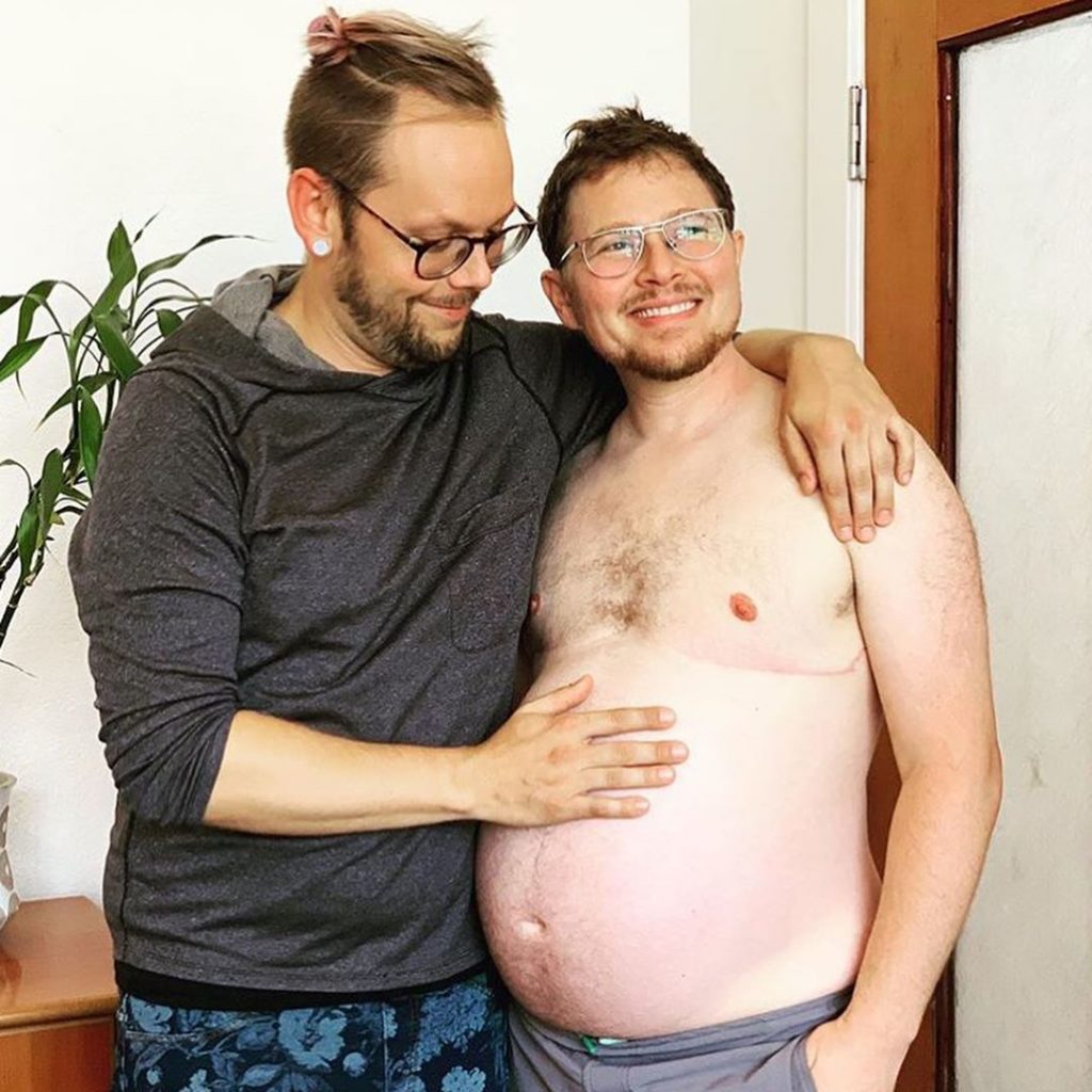 Le potenti foto del parto di Eli, il papà che ha dato alla luce sua figlia