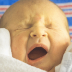 Ittero neonatale: cosa significa quando la pelle del bambino diventa gialla