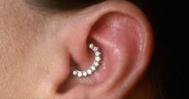piercing emicrania
