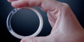 anello concezionale