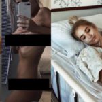"Questa è l'endometriosi: non dobbiamo vergognarcene"