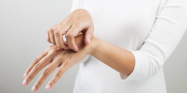 dermatite da stress cure
