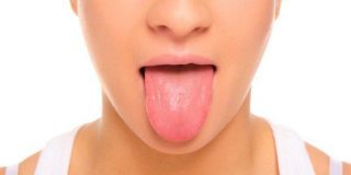 bolle sulla lingua