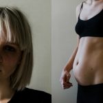 La vita con l'endometriosi raccontata in immagini