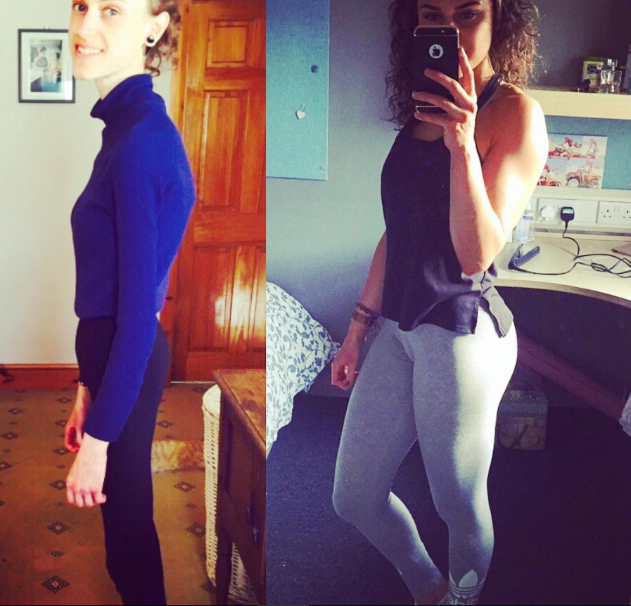 "Io, durante e dopo l'anoressia": la testimonianza in immagini di Emelle
